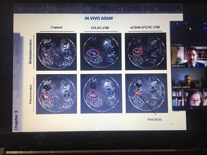 La Universidad de Granada pone en marcha la defensa de tesis doctorales por videoconferencia (UNIVERSIDAD DE GRANADA) 