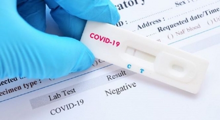 Test PCR para detectar el coronavirus (PLANTA DOCE) Test PCR para detectar el coronavirus (PLANTA DOCE)