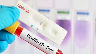 Test del Covid-19
