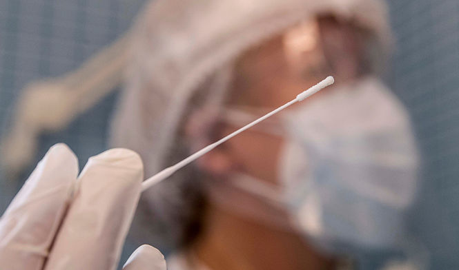 Realización de un Test PCR (JUNTA) 