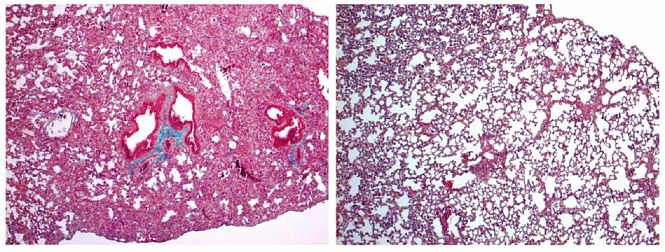 A la izquierda, pulmón de ratón con signos de fibrosis pulmonar grave. A la derecha, pulmón de ratón tratado con cortistatina, en el que el daño es mucho menor (IPBLN-CSIC)