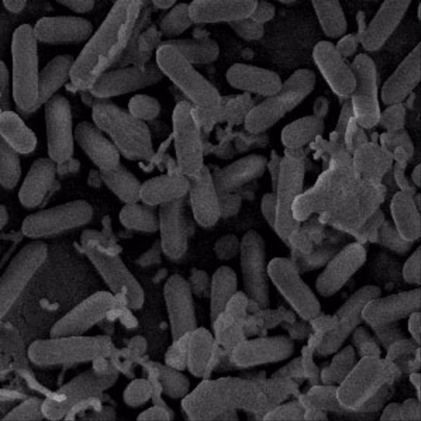 Imagen microscópica de bacterias del género Listeria (CEU UCH) Imagen microscópica de bacterias del género Listeria (CEU UCH)