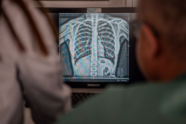 Profesionales visionan un procedimiento hospitalario (HOSPITAL VIRGEN DE LAS NIEVES) 