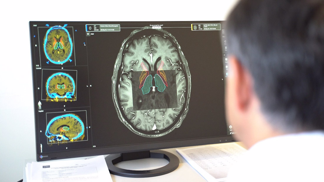 El Hospital Virgen de las Nieves ofrece terapias avanzadas a los pacientes con párkinson (JUNTA DE ANDALUCÍA)