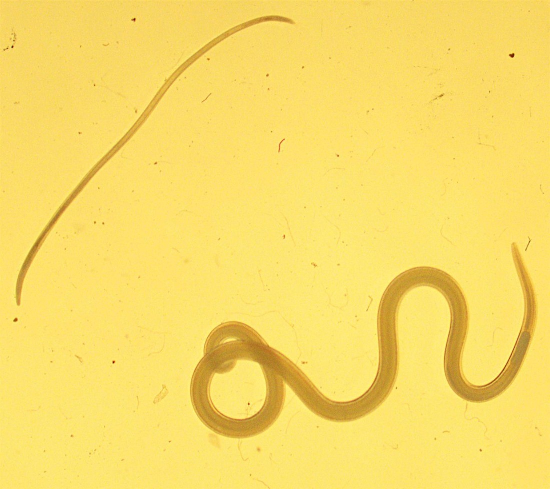 Larvas de anisakis y de Hysterothylacium (UGR)