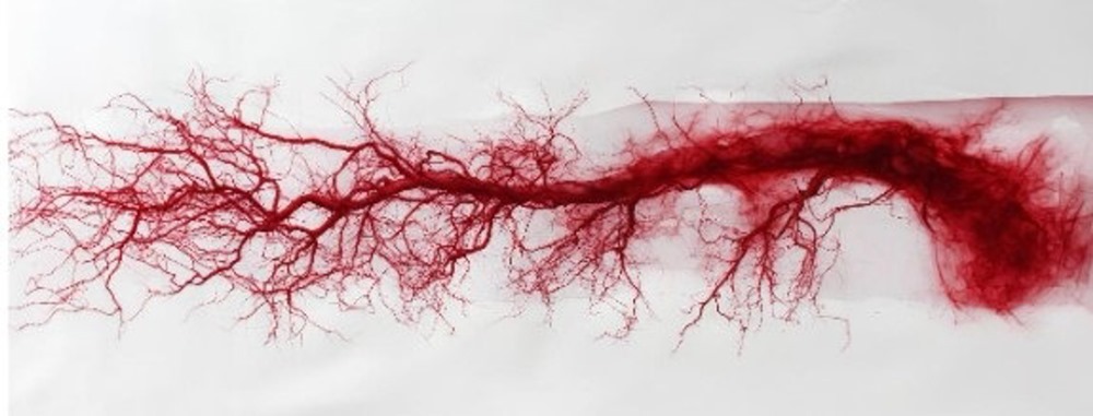 La arteritis de células gigantes afecta principalmente a arterias de gran y mediano calibre, como las que Irrigan la cabeza y el cuello. (CSIC)