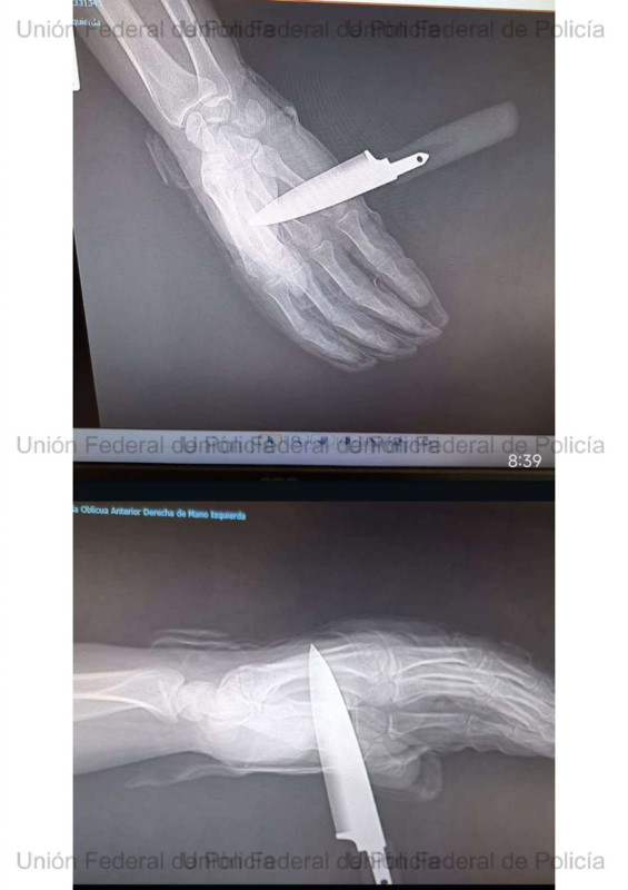 (POLICÍA NACIONAL) (POLICÍA NACIONAL)