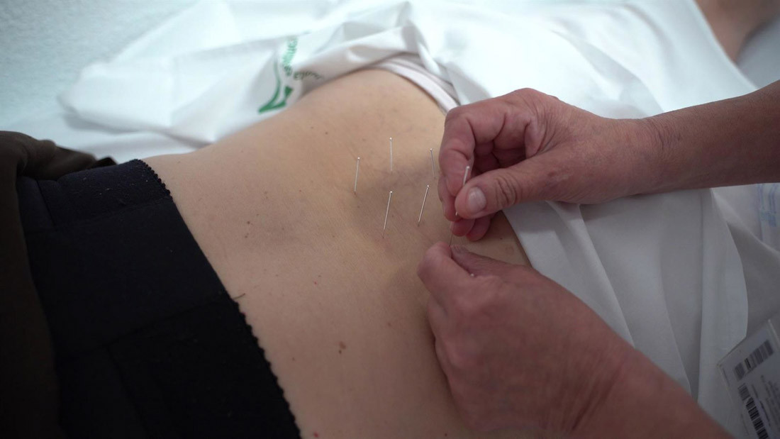 Aplican acupuntura a un paciente en el Hospital Virgen de las Nieves de Granada (JUNTA DE ANDALUCÍA)